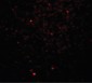CLEC7A / Dectin 1 Antibody (Internal)